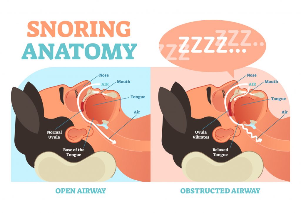 Snoring anatomy medical vector diagram with nose, mouth, tongue and air passage.